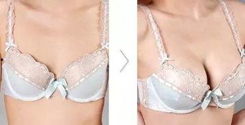 国产隆胸案例视频播放,真实体验与术后效果大揭秘